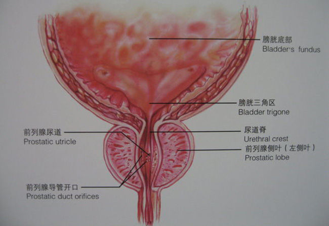 前列腺肥大怎么治疗 虽能治愈如疗法不对也没用