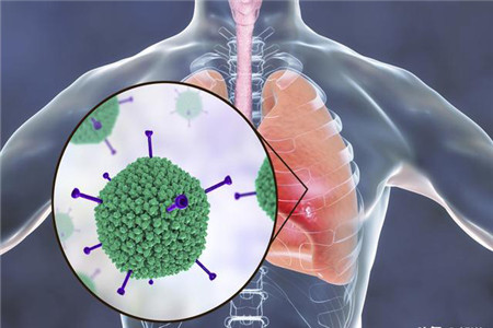 肺炎病毒