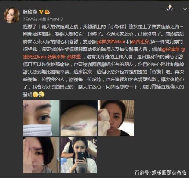 阿娇摔倒是怎么回事：阿娇和赖国弘为什么离婚