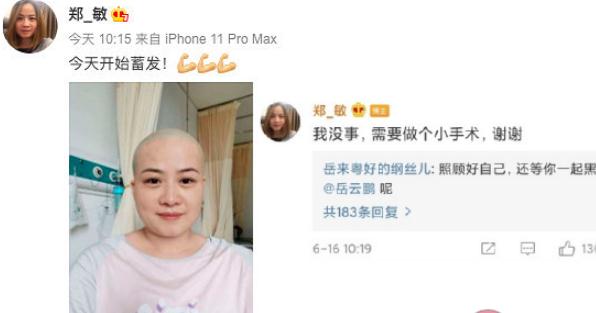 岳云鹏妻子是谁？岳云鹏老婆为什么剃光头？